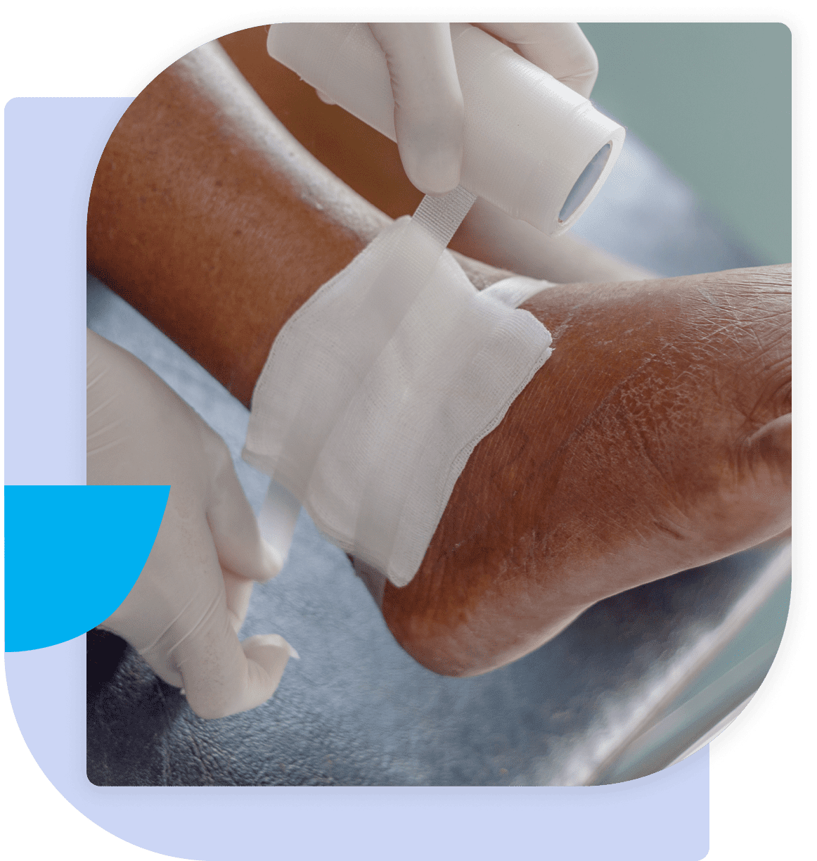 A person with bandages on their feet and arm.